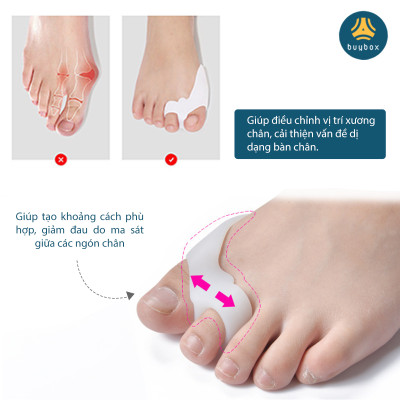 Combo 3 Cặp nẹp silicone tách ngón, bảo vệ đinh hình ngón chân cái - Buybox - BBPK281 