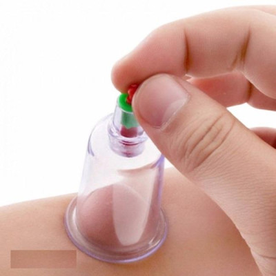 Bộ giác hơi 12 món không dùng lửa (cao cấp) Giúp giảm các chứng đau lưng; đau đầu; cảm cúm; nhức mỏi