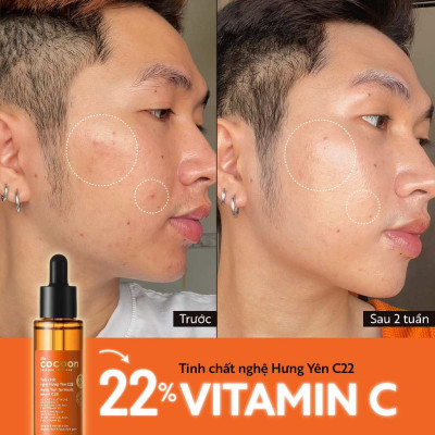 Tinh chất nghệ Hưng Yên C22 với 22% vitamin C sáng da chuyên sâu & mờ vết thâm Cocoon 30ml