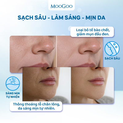 Tẩy tế bào chết cám gạo cho da nhạy cảm, da dầu mụn da khô Gentle Exfoliating Micro Powder -  MooGoo Úc