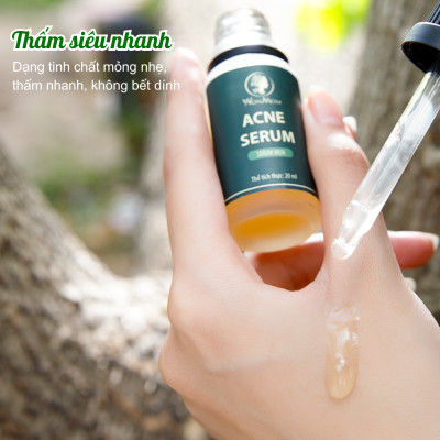 Acne serum đánh bay mụn, sạch thâm sẹo, dưỡng trắng da Wonmom 20ml