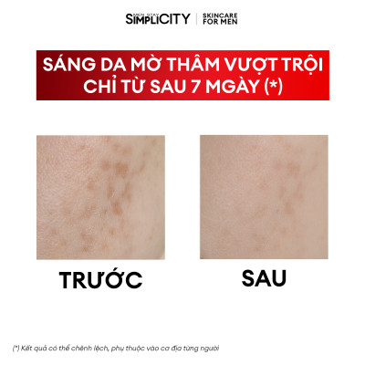 Serum Men Stay Simplicity sáng da mờ thâm với Niacinamide 5% Vital Facial Skin Brightening 30ml