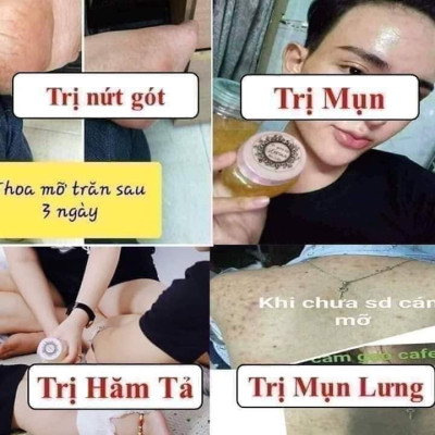 Mỡ Trăn N