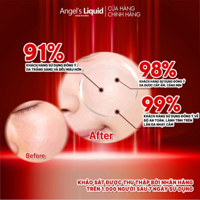 Serum Dưỡng Trắng Da, Cấp Ẩm Đa Tầng Angel