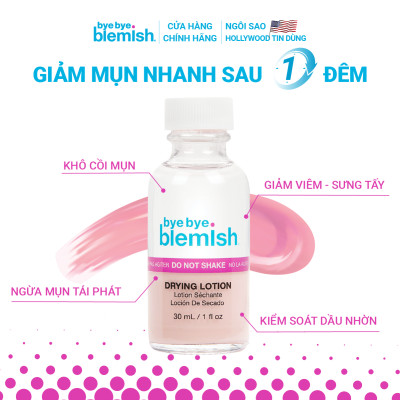Chấm Mụn Giảm Mụn Nhanh Sau 1 Đêm Dành Cho Mụn Trắng, Sưng Đỏ Bye Bye Blemish Original Drying Lotion 30ml