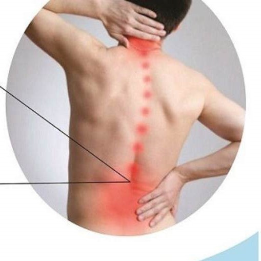 3 Bài Thuốc Đông Y Chữa Gai Cột Sống