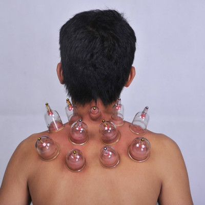 Bộ Giác Hơi Không Dùng Lửa Duy Thành YGH02