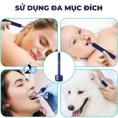 Dụng cụ ngoáy tai thông minh Bebird X17 Pro, phiên bản nâng cấp từ Bebird M9 Pro với camera full HD