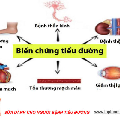 Sữa tiểu đường và đái tháo đường gluna 800g TOPTEN milk MilkMilk