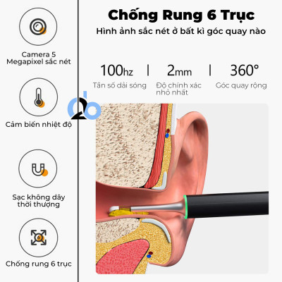 Dụng cụ ngoáy tai thông minh Bebird X17 Pro, phiên bản nâng cấp từ Bebird M9 Pro với camera full HD